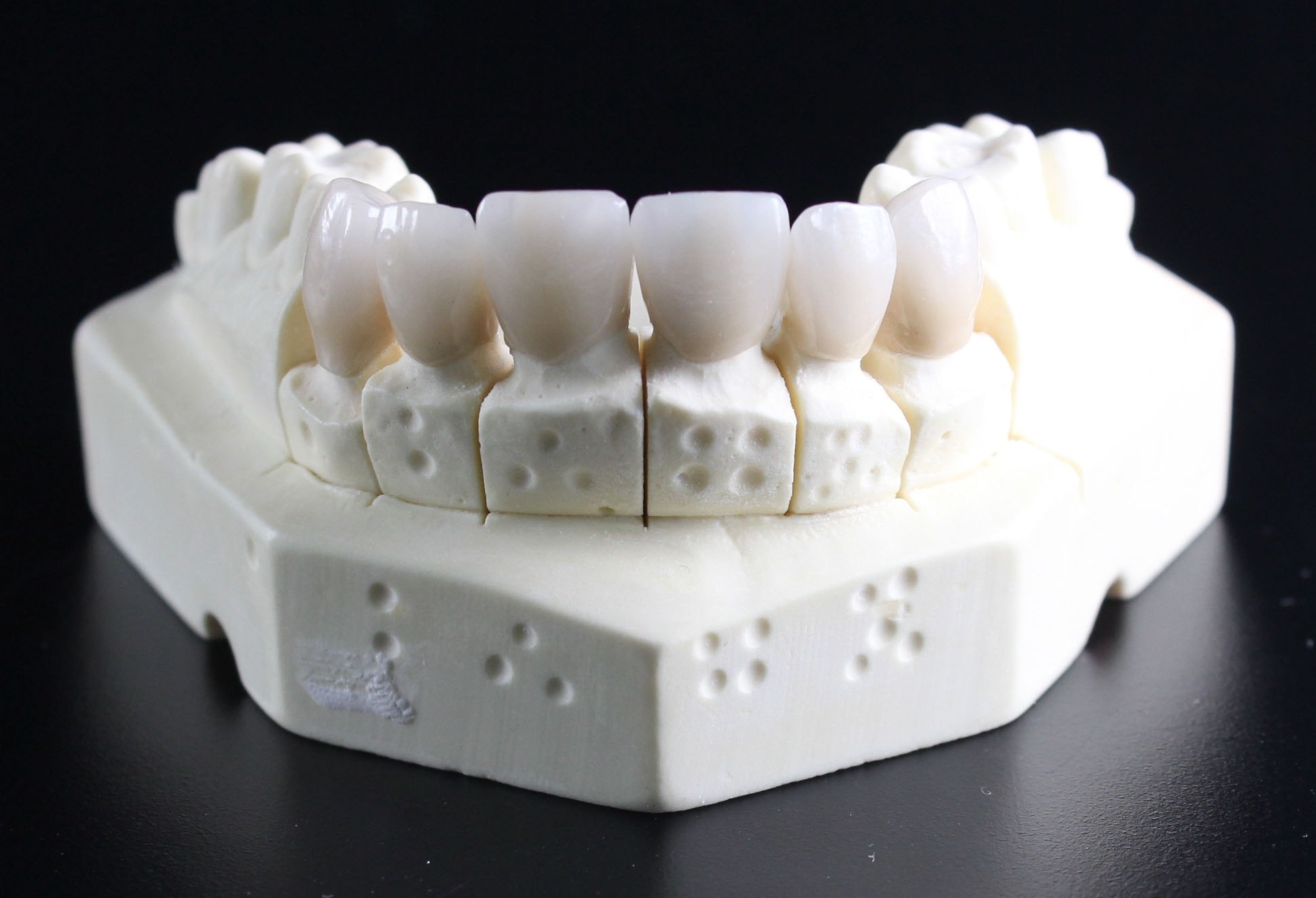 white dental dentures