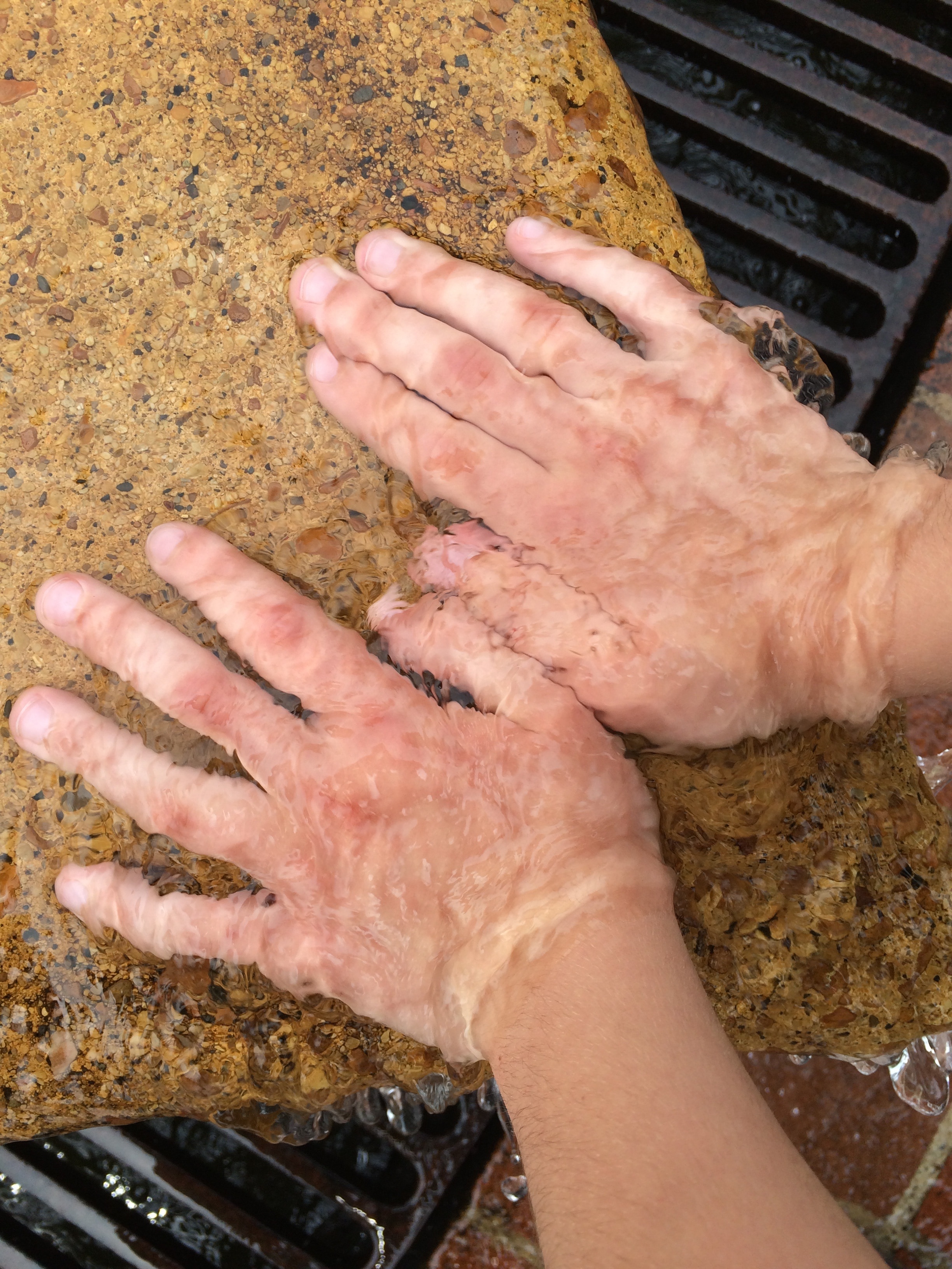 human hand skin condition