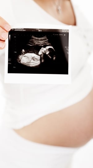 baby's ultrasound photography thumbnail