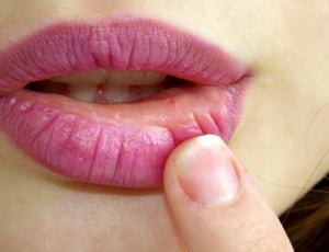 women's lips thumbnail