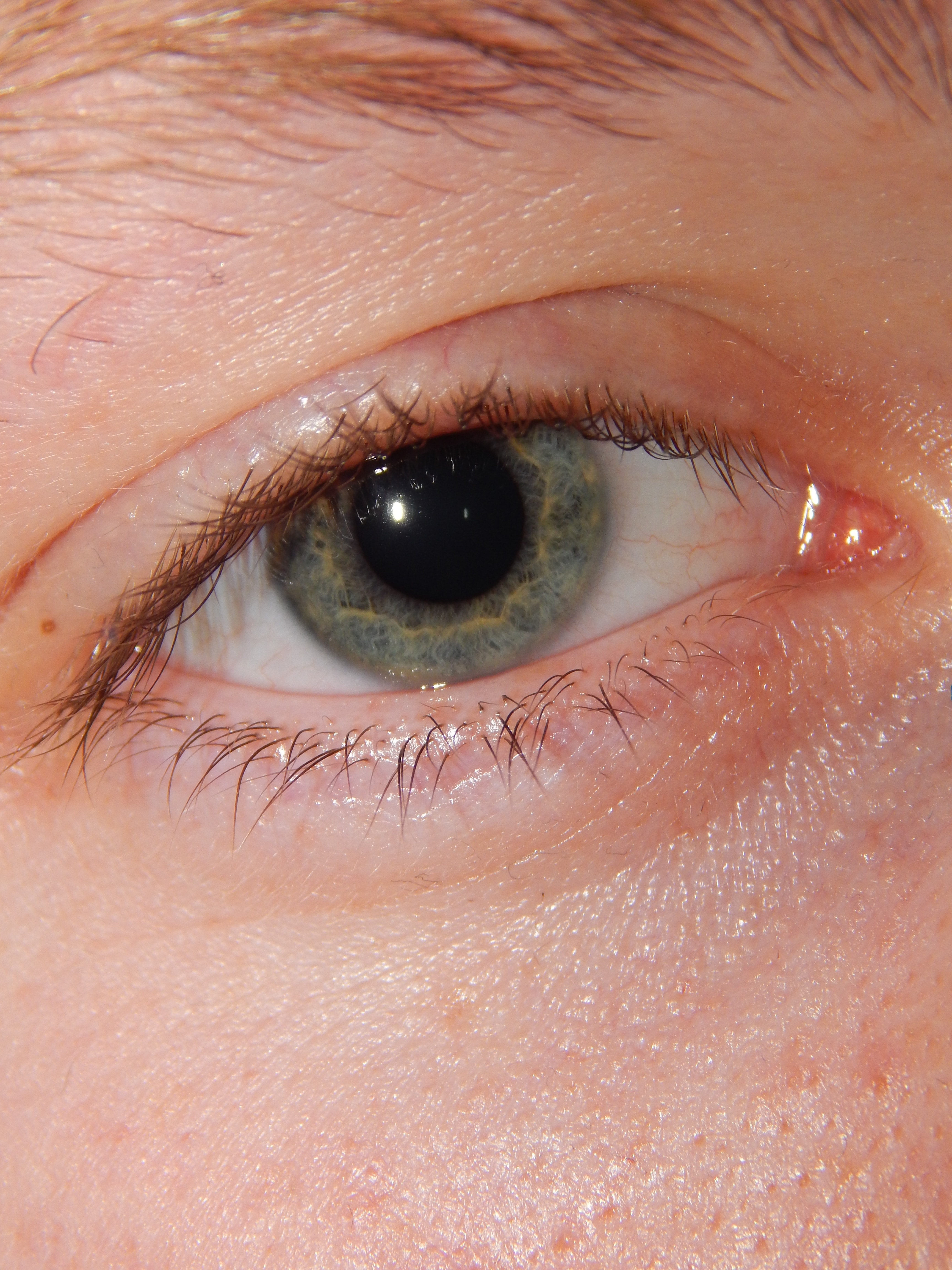 black eyelids